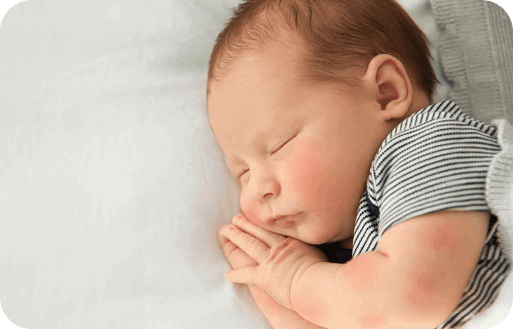 Schlafendes Baby mit roten Wangen | Babyservice